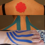 Kinesio Tape